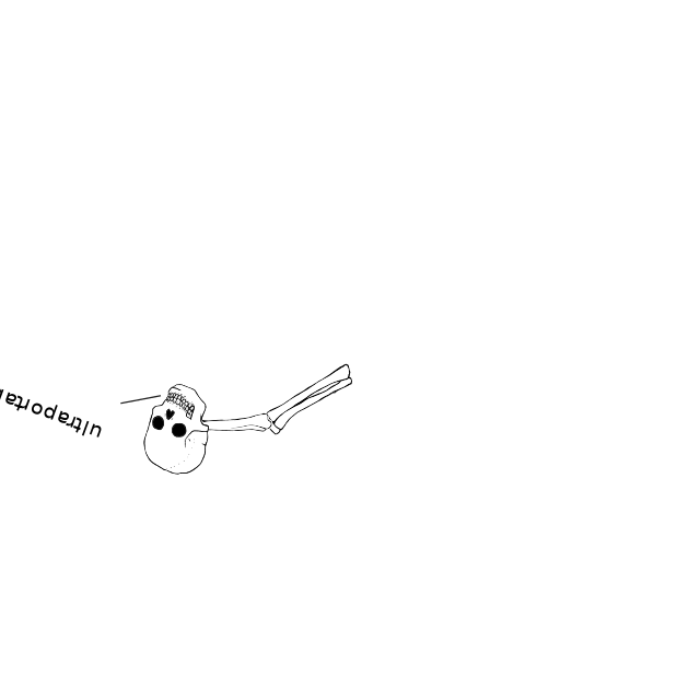 Dem bones dem bones dem – dry bones!