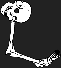 Dem bones dem bones dem – dry bones!