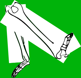 Dem bones dem bones dem – dry bones!