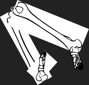 Dem bones dem bones dem – dry bones!  | Dem bones dem bones dem – extra bones!