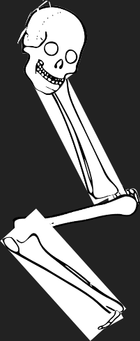 Dem bones dem bones dem – dry bones!
