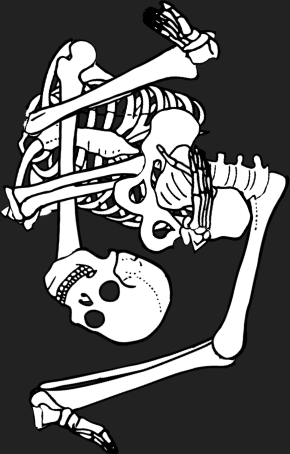 Dem bones dem bones dem – dry bones!