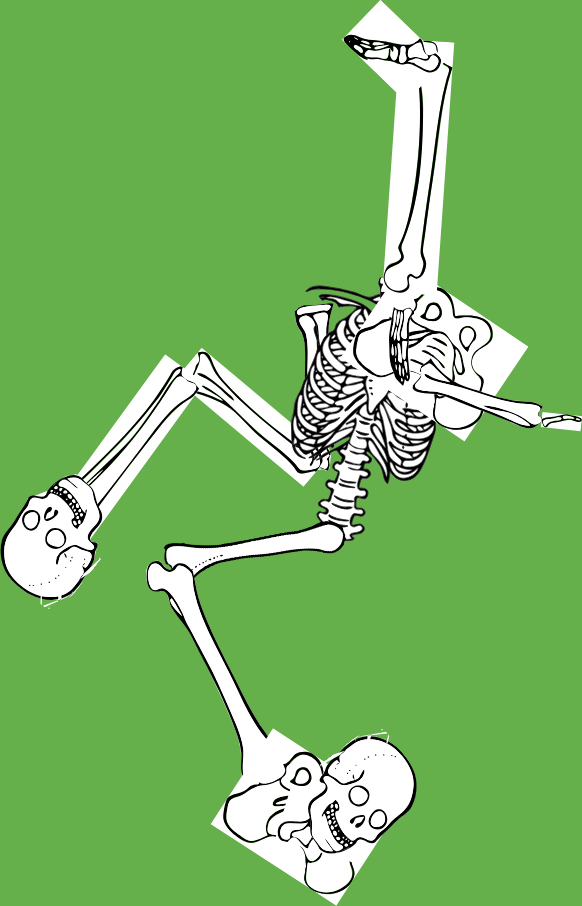 Dem bones dem bones dem – dry bones!