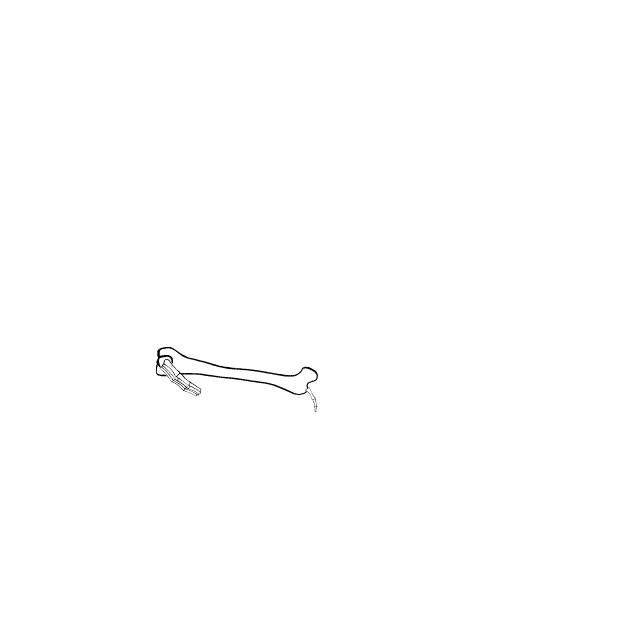 Dem bones dem bones dem – dry bones!