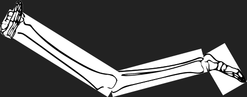 Dem bones dem bones dem – dry bones!