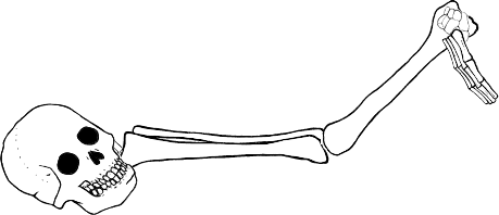 Dem bones dem bones dem – dry bones!