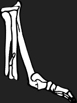 Dem bones dem bones dem – dry bones!