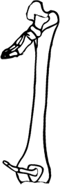Dem bones dem bones dem – dry bones!