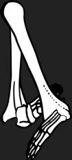 Dem bones dem bones dem – dry bones!
