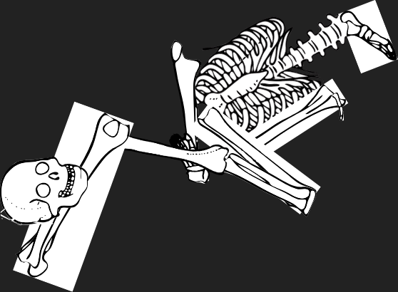 Dem bones dem bones dem – dry bones!