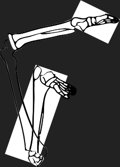 Dem bones dem bones dem – dry bones!