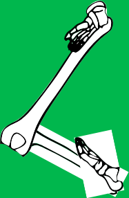 Dem bones dem bones dem – dry bones!
