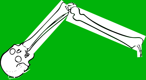 Dem bones dem bones dem – dry bones!