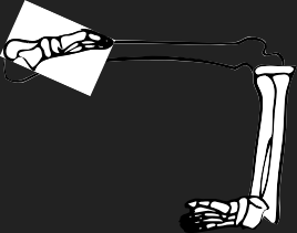 Dem bones dem bones dem – dry bones!