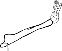 Dem bones dem bones dem – dry bones!