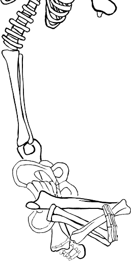 Dem bones dem bones dem – dry bones!