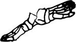 Dem bones dem bones dem – dry bones!