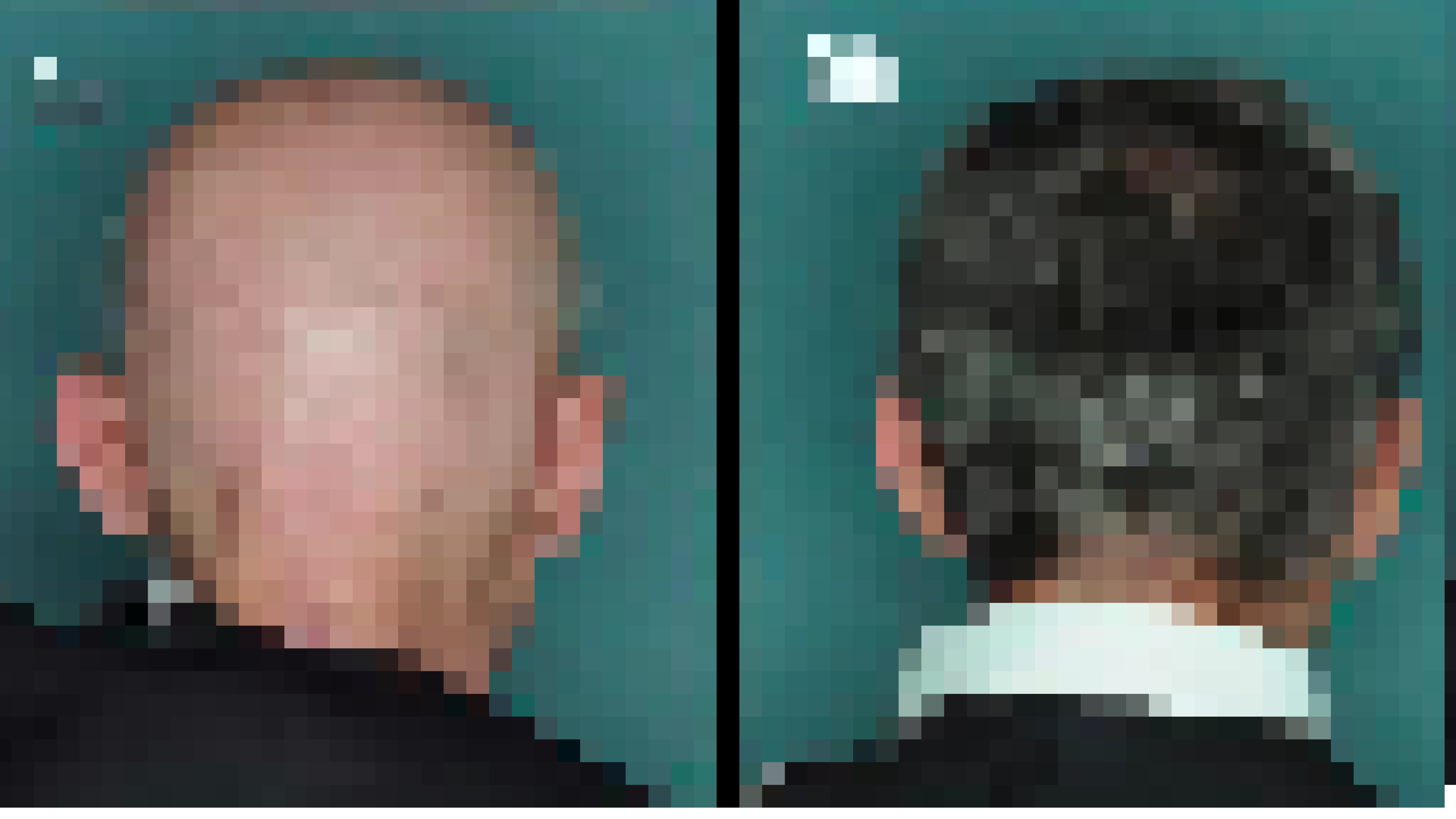 baldness