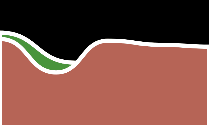 Hills!