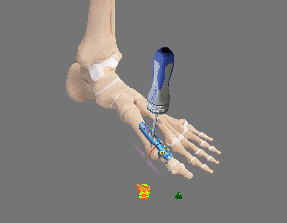 ♫ DOO DOO DOO DOO! ♪ (forefoot)