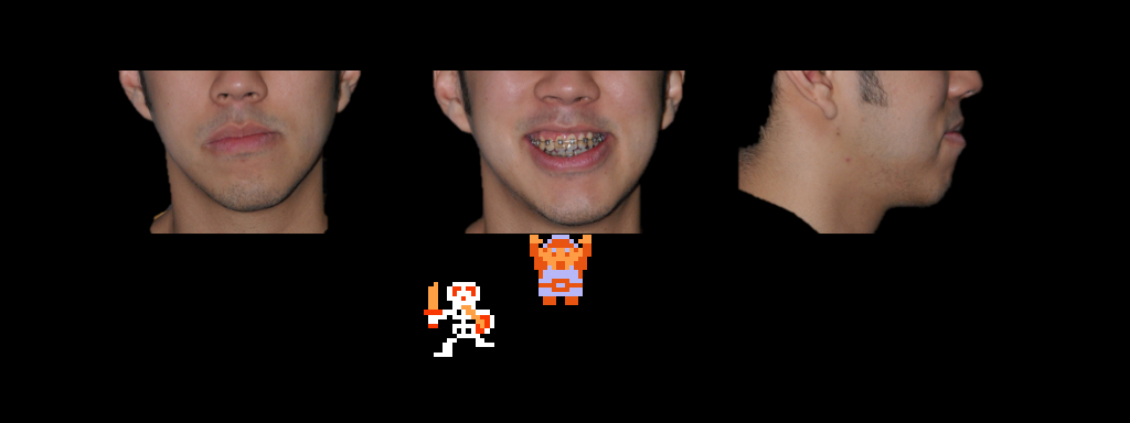 ♫ DOO DOO DOO DOO! ♪ (asymmetry)