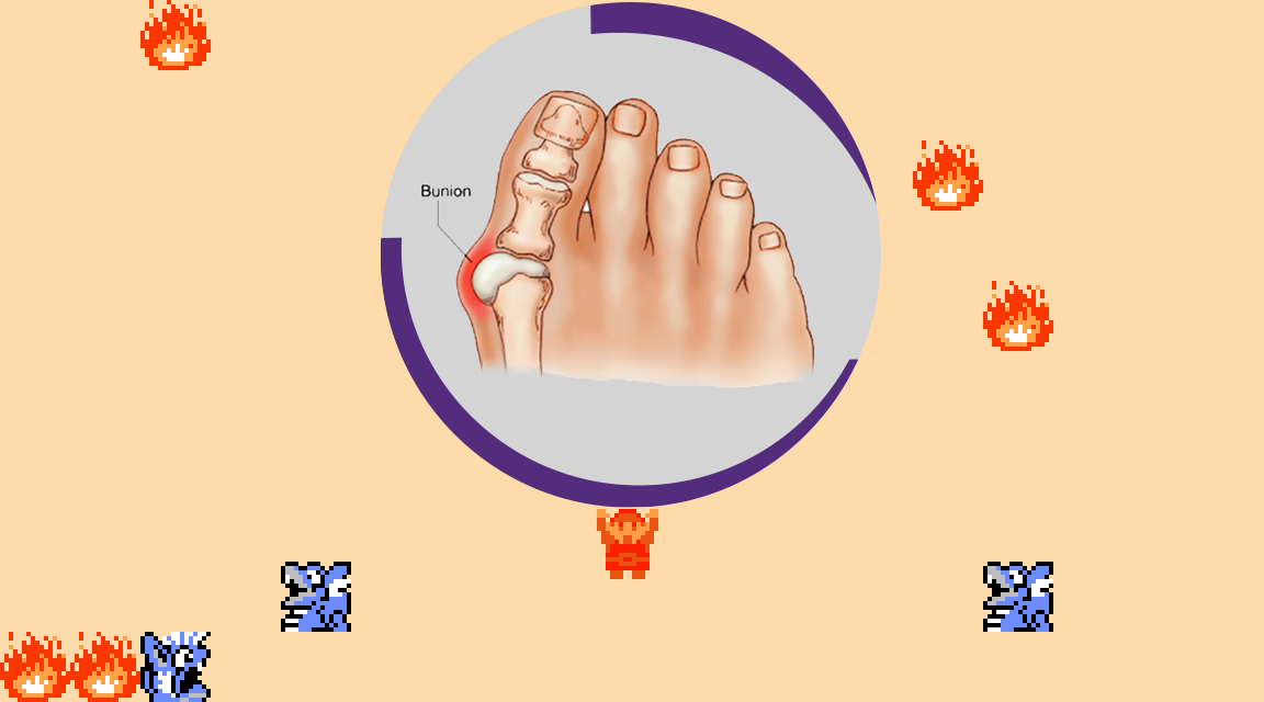 ♪ DOO DOO DOO DOO! ♩ (bunion)