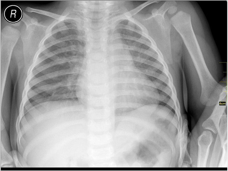 tag ur self I'm the medical radiography