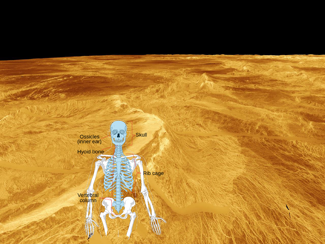 An Unexpected Discovery ; Venus - 3-D Perspective View of Latona Corona and Dali Chasma! PIA00268
