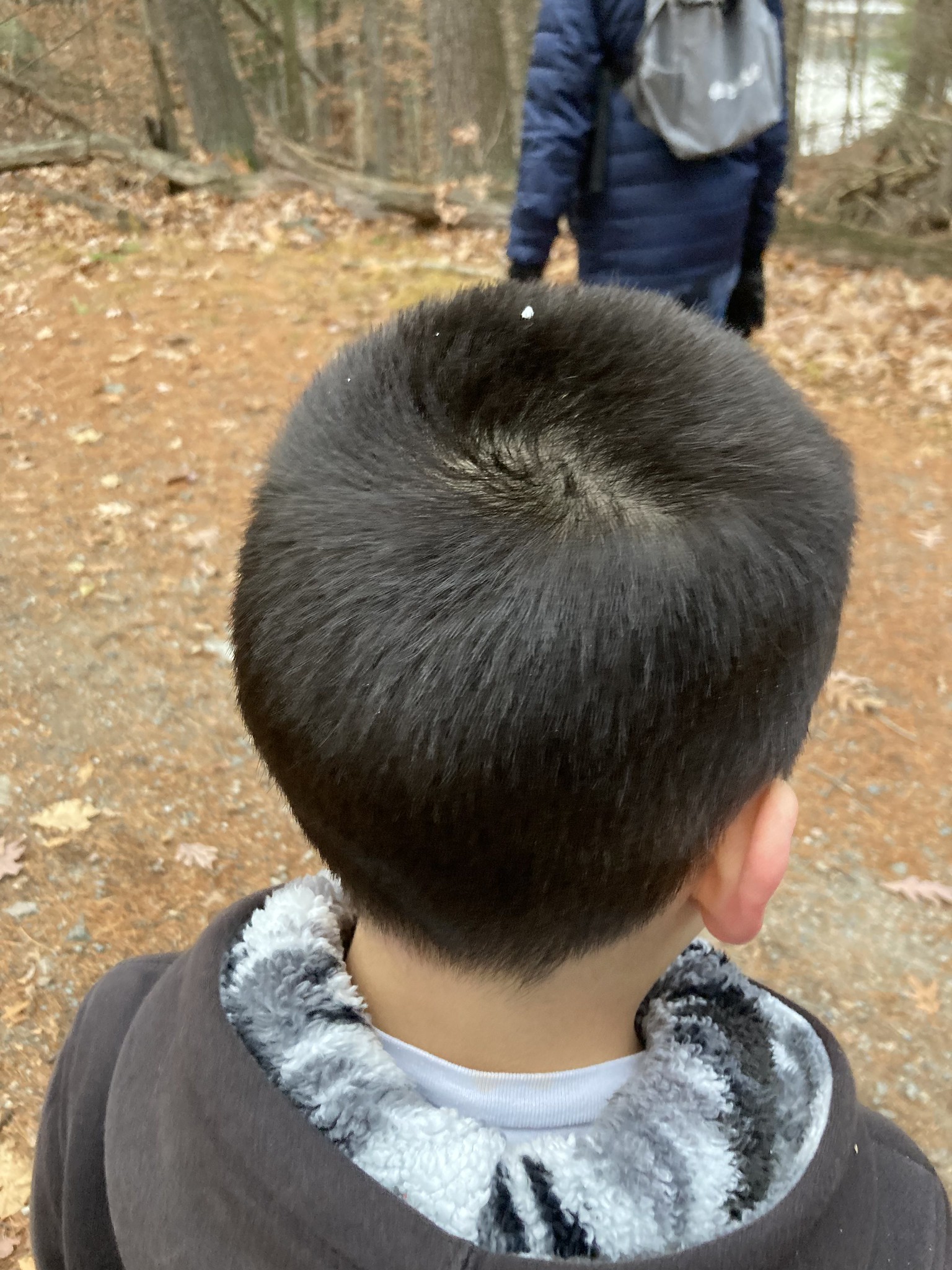 White pellet on kid's head