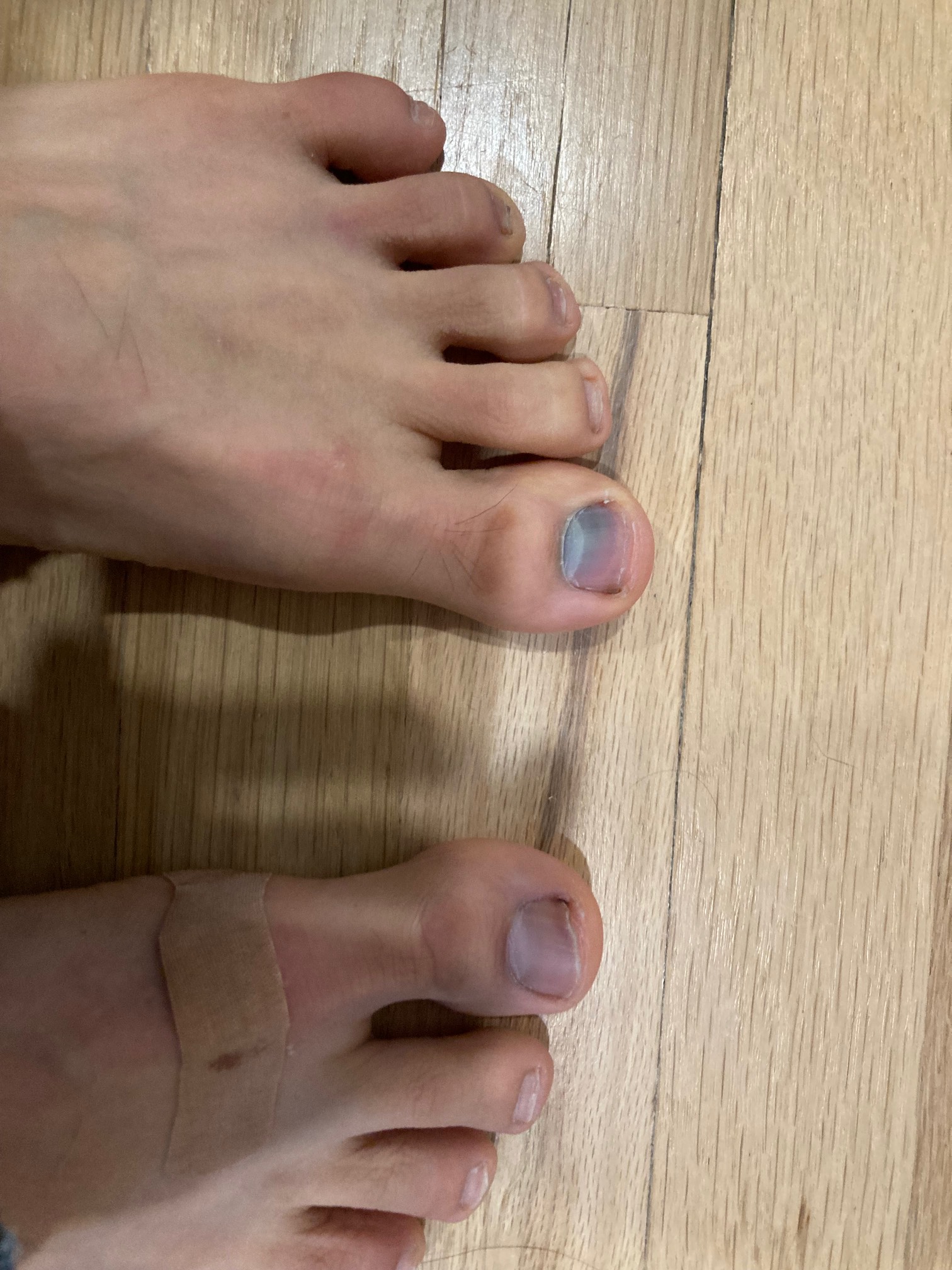 Foot with blue toe